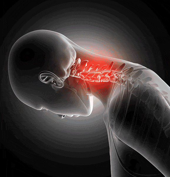 ergonomisches Nackenkissen zervikal, Memory Schaum Nackenkissen zervikal, Nackenkissen zervikal, kontur Nackenkissen zervikal, beste Nackenkissen zervikal
